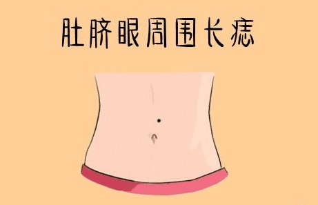 女腹部痣图片